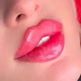 لیزر | ژل | بوتاکس | فیلر | نخ | قم