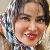 تزریق ژل لب و بوتاکس و قرینه سازی چهره