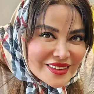 تزریق ژل لب و بوتاکس و قرینه سازی چهره