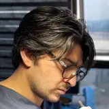 کاشت مو نوید??