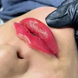 ژل لب روسی و بوتاکس اصفهان