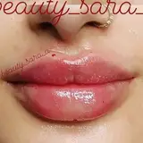 beauty_injections_ahvaz