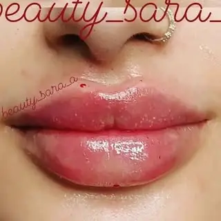 beauty_injections_ahvaz