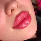 ?ژل و بوتاکس اسلامشهر?