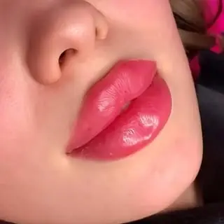 ?ژل و بوتاکس اسلامشهر?