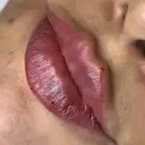 کیلینیک ژل و بوتاکس پرند
