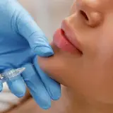 دکتر حمید طاشی|لیزر، بوتاکس، فیلر، لاغری، اندولیفت، فیشیال|گرگان