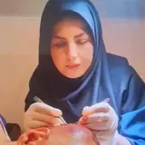 کاشت مو => زنجان - تهران
