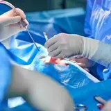 لیپو۳۶۰/پروتز سینه/لیپوماتیک/ابدو/ماموپلاستی/پیکرتراشی