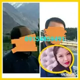 کاشت مو مشهد ؛بجنورد