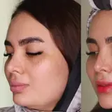 اموزش ژل و بوتاکس خرم اباد