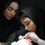 کاشت مو|ترامو|هیرفیلر|مزوتراپی|یزد