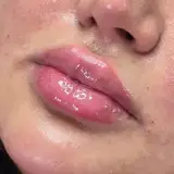 زیبایی هژین