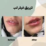 مرکز لیزر پیروزی