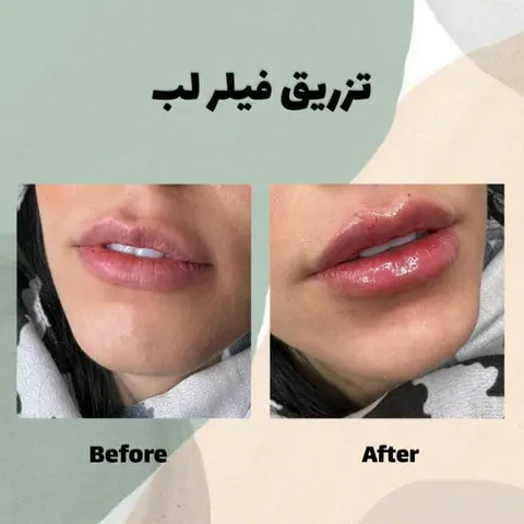 مرکز لیزر پیروزی
