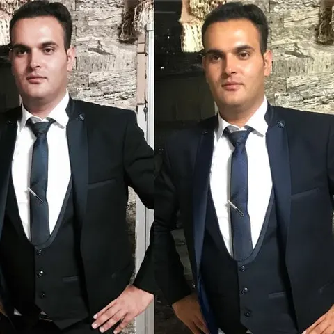 کلینیک تخصصی کاشت موی طبیعی ، لیزر و زیبایی ایرانیان (دکتر کهنموئی)شعبه ۲