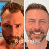 Solve Clinics Hair Transplant New York