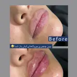 کلینیک کاشت مو سی گل مشهد