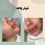 One1_beauty center