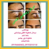 مرکز لیزر الماس