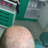 کاشت مو بیرجند