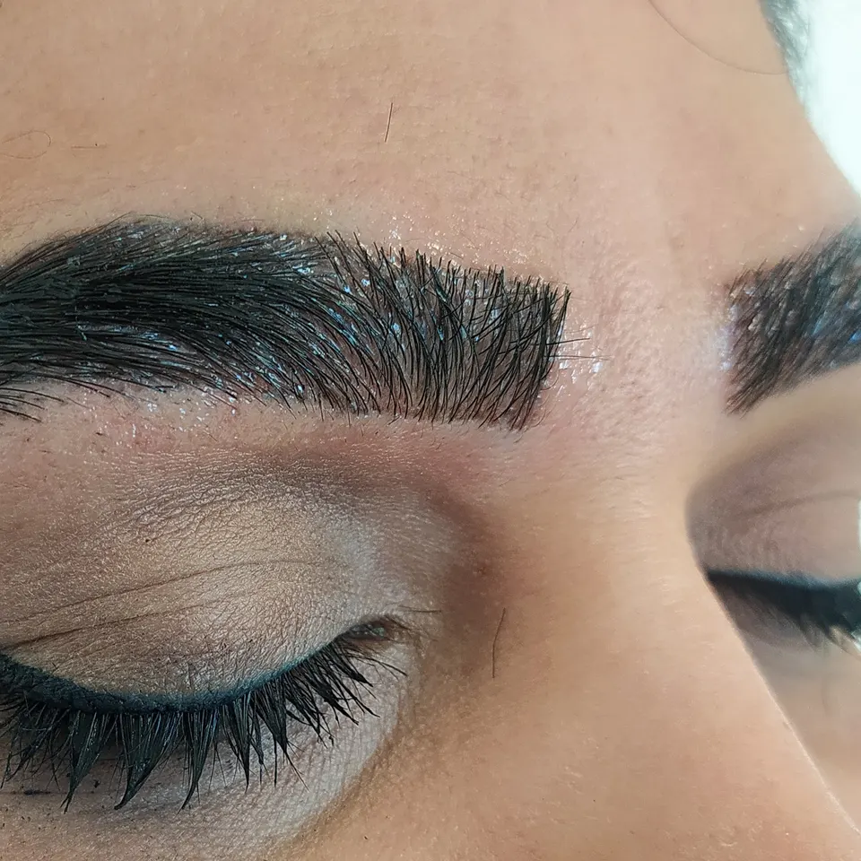 کلینیک تخصصی کاشت مو سنه کاشت