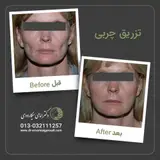دکتر امامی سیگارودی