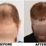 ForHair NYC Restoration Clinic - Dr. John Cole