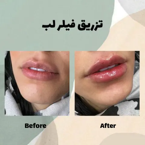 مرکز لیزر پیروزی
