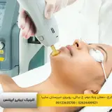لیزر موهای زائد در کرج