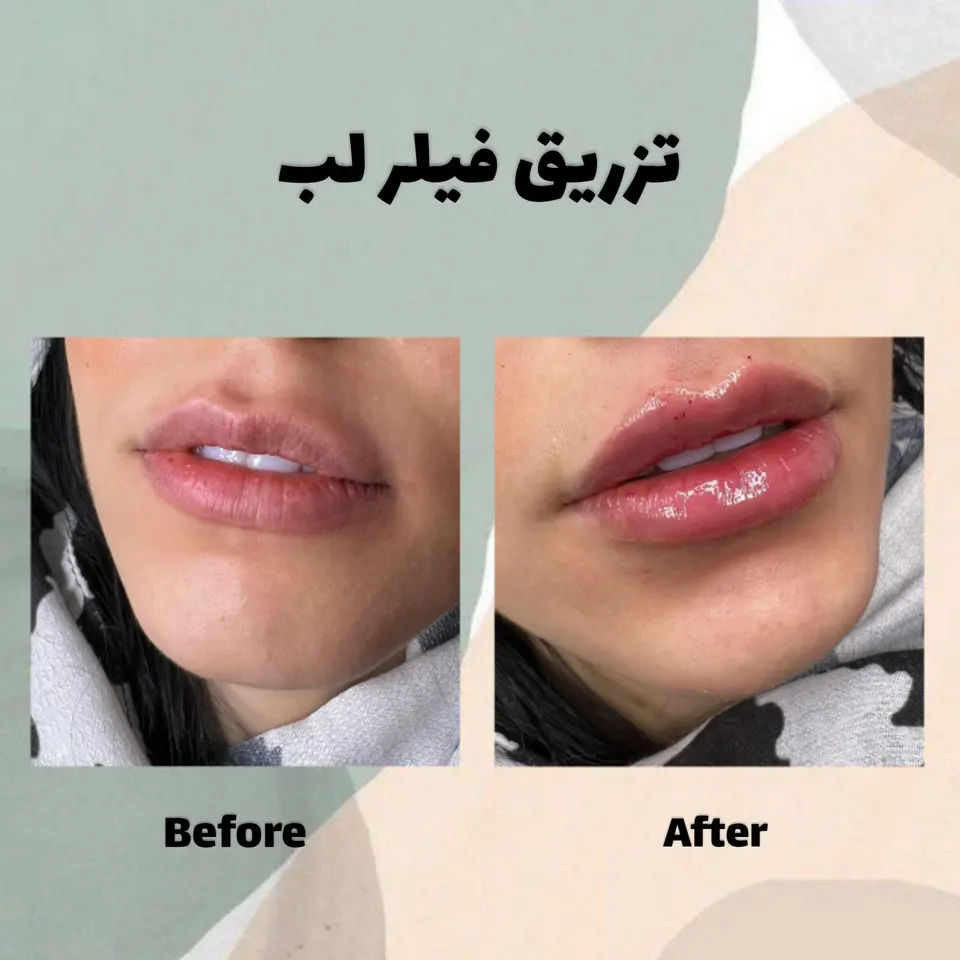 کلینیک پوست پیروزی