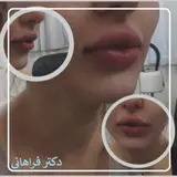 مطب دکتر فراهانی