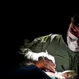 بلفارو پلاستی | مطب چشم پزشکی