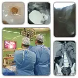 dr.Inanloo(endourologist)