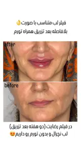 مطب زیبایی دکتر سما ( با تخفیف ویژه )