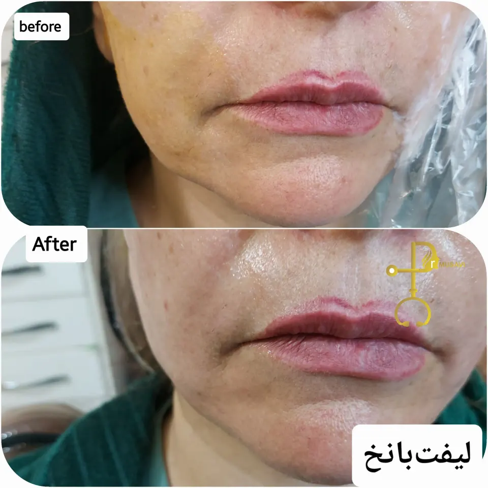 کلینیک زیبایی بوتاکس لیزر فیلر شجاعی