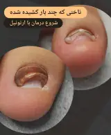 پودولوژی هیوا