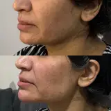 خدمات تخصصی تزریق ژل و بوتاکس النور