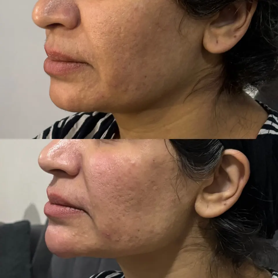 خدمات تخصصی تزریق ژل و بوتاکس النور