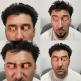 کلینیک پوست مو لیزر و لاغری عصر زیبایی