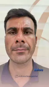 کلینیک لیزر و پوست و مو و زیبایی آرشینو