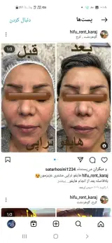 Haifu kermanshah کلینیک زیبایی