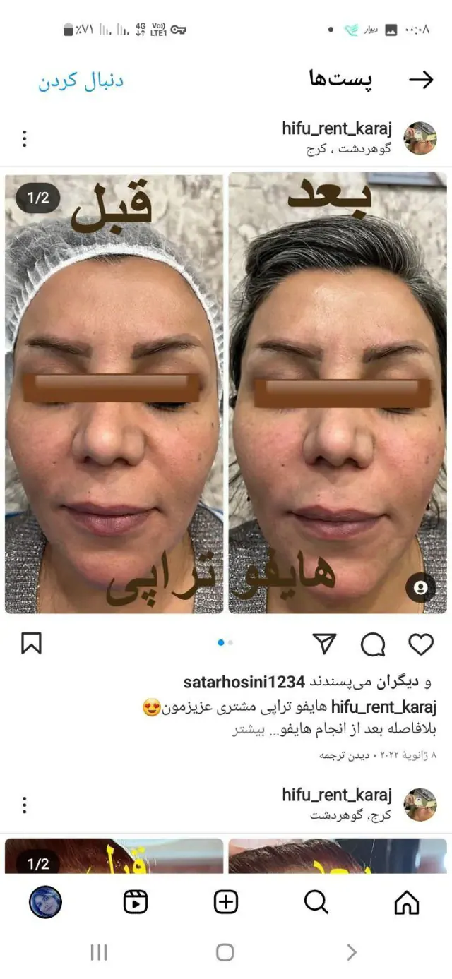 Haifu kermanshah کلینیک زیبایی