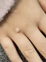 مطب دکتر پیمان پاکروان