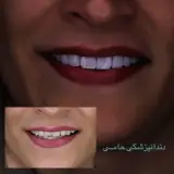 دندانپزشکی حامی (طرف قراردادبیمه نیستیم)