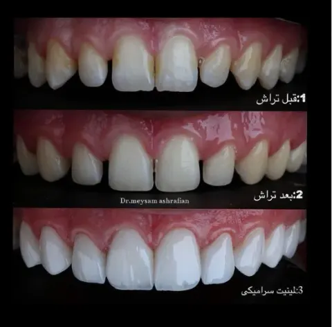 دکتر میثم اشرفیان