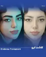 تاران کاشت