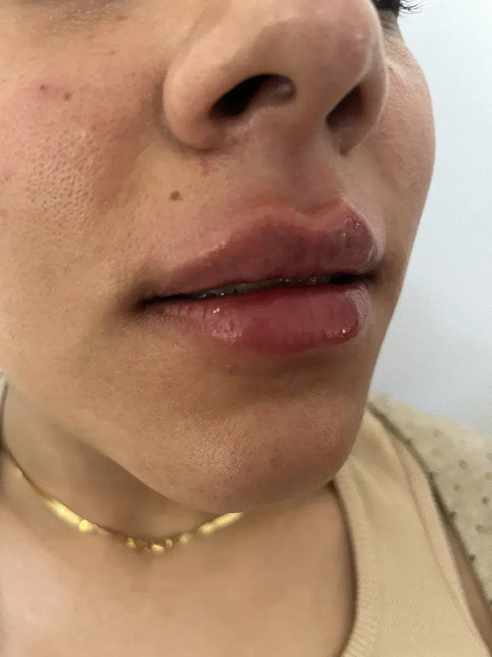 کلینیک زیبایی مارول