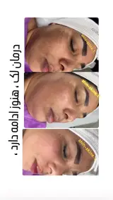 خدمات زیبایی skin_shin.1