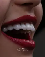 دندانپزشکی دیجیتال دکتر نازنین مهرآور